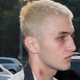 Anwar Hadid and his hickey